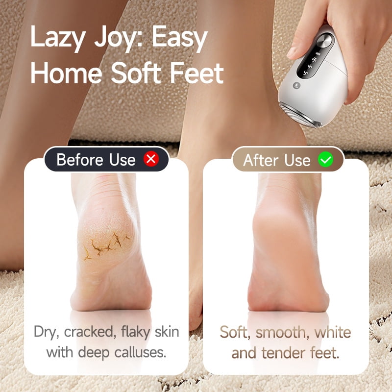 Rechargeable Electric Callus Remover for Feet – Waterproof Pedicure Tool with LED Display, 3 Adjustable Speeds, Stainless Steel Heads & Low Noise Motor