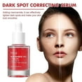 thumbnail image 4 of 30ml Dark Spot Correcting Serum 10% Niacinamide + 4%Tranexamic Acid for Post Acne Marks, 4 of 5
