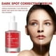 thumbnail image 4 of 30ml Dark Spot Correcting Serum 10% Niacinamide + 4%Tranexamic Acid for Post Acne Marks, 4 of 5