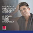 thumbnail image 6 of (4 pack) Taro Minoxidil Topical Aerosol Foam, 5%, Hair Regrowth Treatment for Men, 2.11 oz, 6 of 9