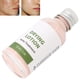 thumbnail image 5 of Sero de la Cara Hidratante, Nutritiva para el Tratamiento de Acné de Acné de la Piel para el Acné Acné Acné Suero Facial para Mujeres para el Cuidado de la Piel, 5 of 7