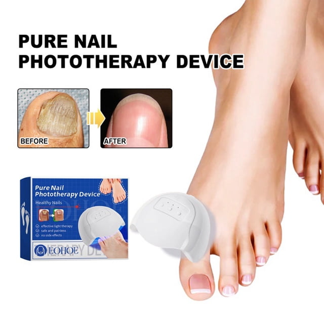 El dispositivo para el cuidado de las uñas repara las uñas podridas, las uñas encarnadas, espesa las uñas, ilumina las uñas, limpia suavemente la onicomicosis y cuida la onicomicosis.