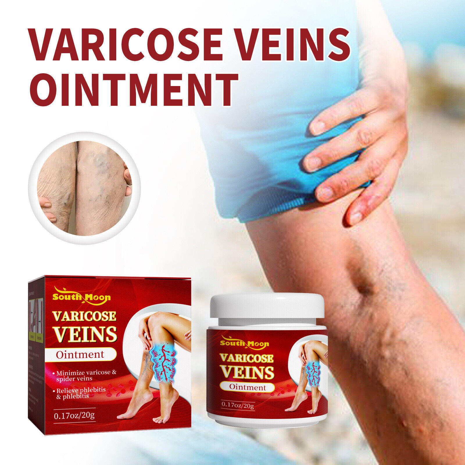 Best Cream Treatment For Varicose Veins Herbal For Varicose Veins