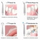 thumbnail image 3 of Dental Water Flosser Spotlight Professional Oral Irrigator Portable Water Flosser Healthy Teeth Whitening Cleaner White, 3 of 4