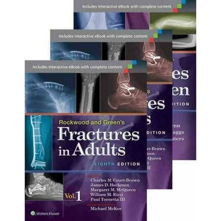 3 adult fracture green in rockwood volume 3 adult fracture green in rockwood volume