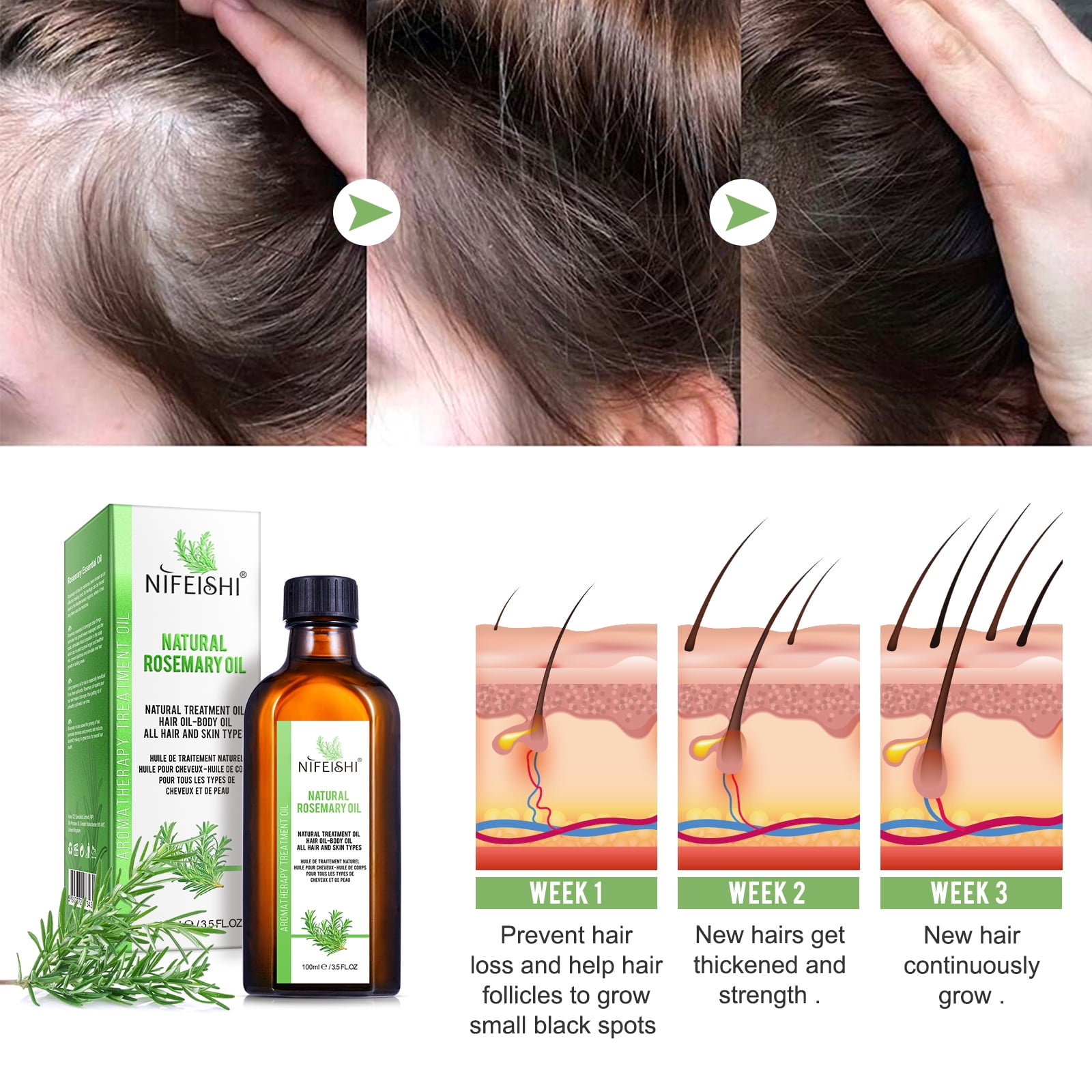  NIFEISHI Rosemary Oil for Hair Growth Organic(4.04 Oz),  Rosemary Mint Scalp & Hair Strengthening Oil with Biotin & Essential Oils,  Hair Growth Oil for Dry Damaged Hair, Skin Care & Face
