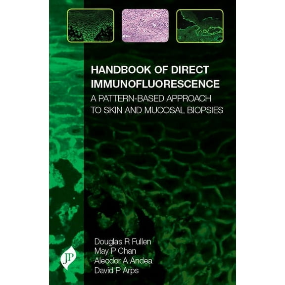 Handbook of Direct Immunofluorescence: A Pattern-Based Approach to Skin and Mucosal Biopsies (Hardcover)