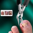 thumbnail image 3 of 3-Pack Ingrown Toenail Clippers for Thick Nails, Stainless Steel Sharp Curved Blade Nail Nipper for Seniors & Adults, Men & Women, 3 of 10