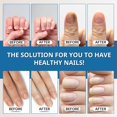 thumbnail image 5 of ABERA Nail Repair Serum – Nourishing Care for Brittle & Weak Nails – Supports Smooth, Healthy-Looking Nails (Blue), 0.68  fl oz, 5 of 7