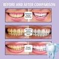 thumbnail image 3 of Jaysuing Mousse Toothpaste Bright White Teeth Dazzling White Yellow Teeth Smoke Stains Coffee Stains Fresh Breath Brightening White Too, 3 of 5