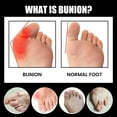 thumbnail image 7 of Anti Bunions Health Socks, Bunions Relief Socks, Orthopedic Compressing Sock, Women Toe Socks Breathable Five Finger Split Toe Socks, 7 of 7