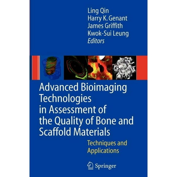 Advanced Bioimaging Technologies in Assessment of the Quality of Bone and Scaffold Materials: Techniques and Application, (Paperback)