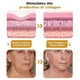 thumbnail image 2 of Bee-Venom Wrinkle Cream Bee-Venom Wrinkles Removal Firming Cream Bee-Venom Anti Wrinkle Anti-Aging Lifting & Recovery for All Skin Types Cream, 2 of 5