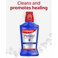 (6 pack) Colgate Peroxyl Alcohol Free Mouthwash and Mouth Sore Rinse ...