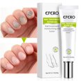 thumbnail image 3 of 1/2x EFERO Nail Repair ence Remove Onychomycosis Serum Fgal Nail Treatment S9L3, 3 of 7