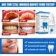 thumbnail image 5 of Fiudx Ofertas y liquidaciones Suero blanqueador dientes en gel Higiene bucal Eficaz para eliminar manchas y placa Limpieza de dientes Cuidado Pasta de dientes 10 ml, 5 of 7