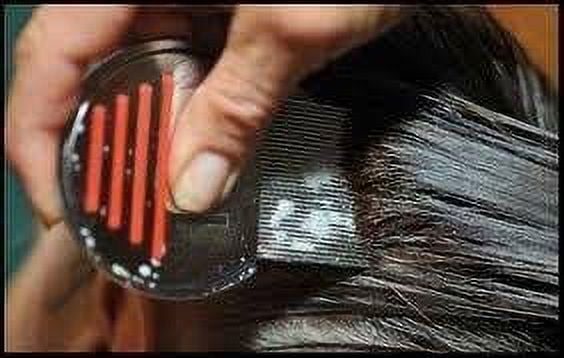 Nit Free Terminator Lice Comb - Professional Stainless Steel Comb for Effective Head Lice Treatment (Color May Vary) (Pack of 1)