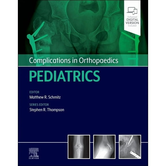 Complications in Orthopaedics Complications in Orthopaedics: Pediatrics, (Hardcover)