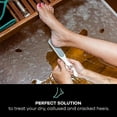 thumbnail image 5 of Dermasuri Callus Remover - Double-Sided Foot File Pedicure, Soften Cracked Heels for Dry Skin, 5 of 7