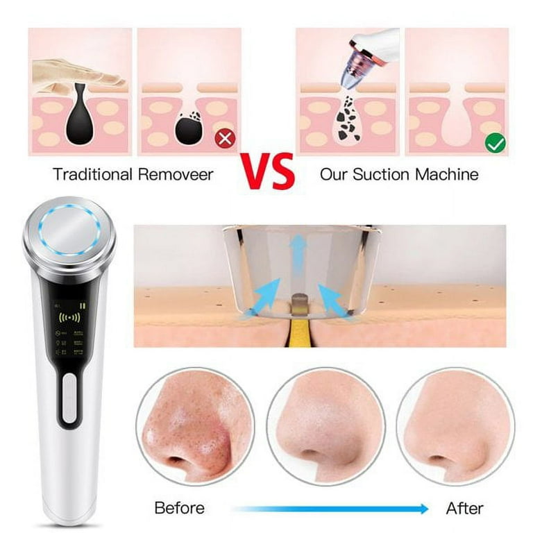 Chelaskin Fast Action 30ml 未使用 Chelaskin Fast Action 30ml 未使用 ネオケラスキンクリーム