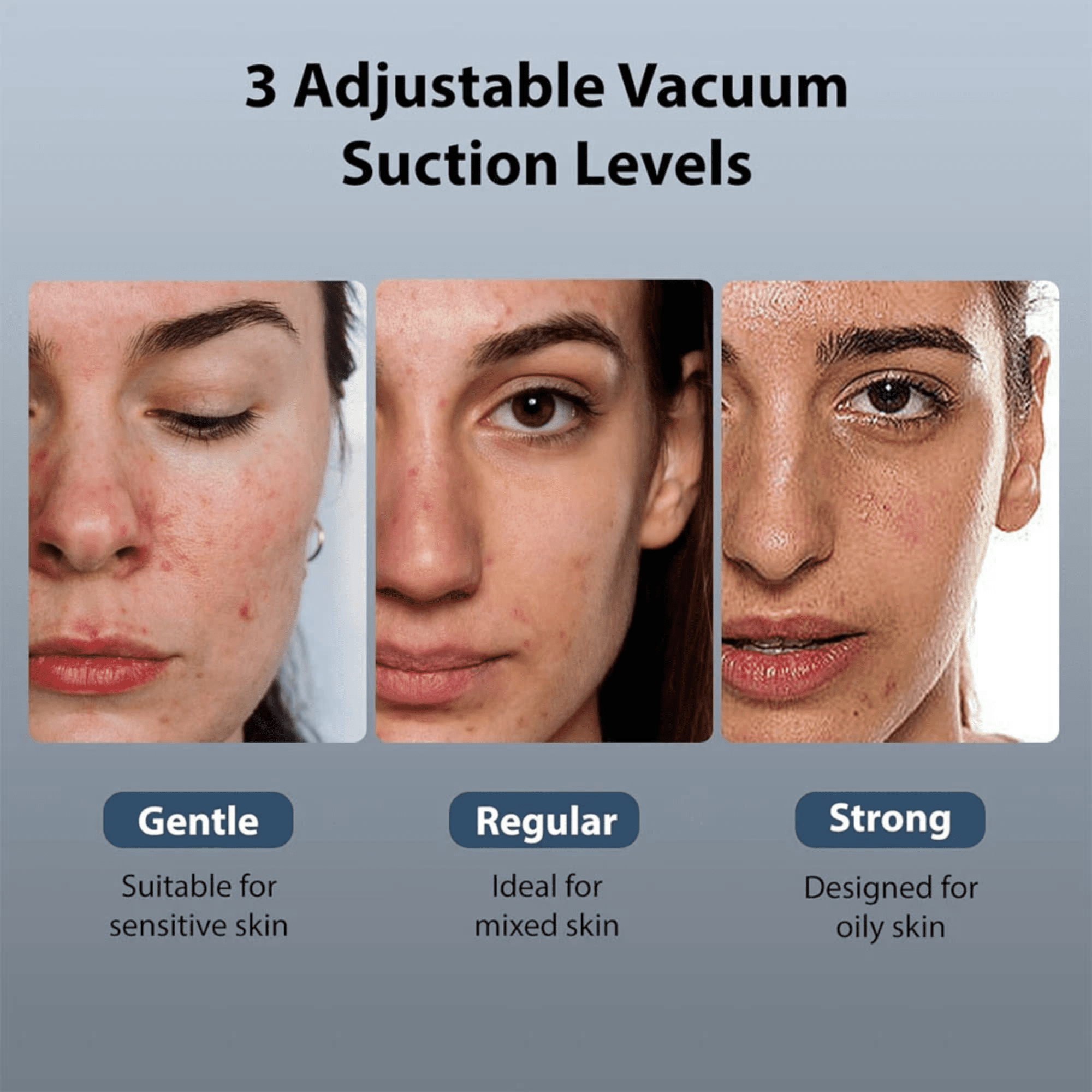 Vibeat 5-in-1 Blackhead Remover Vacuum, Facial Pore Cleanser Device with Warming & Icing, Spa Facial Tool at Home