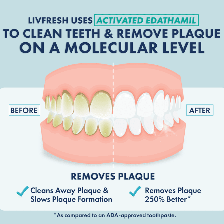 LIVFRESH Dental Gel by Livionex - Clinically Proven to Remove