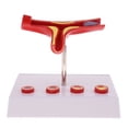 thumbnail image 2 of Estatua de Aterosclerosis de Vaso Sunnimix Modelo de Estudio Ampliación 50X, 2 of 8