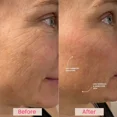 thumbnail image 4 of EvenSkyn Lumo Baguette de Beauté RF Anti-âge et Raffermissante pour la Peau – Réduit les Rides, Rehausse la Peau et Augmente le Collagène – EMS Avancés et Rafraîchissants pour des Résultats Visibles à la Maison - Rose, 4 of 9