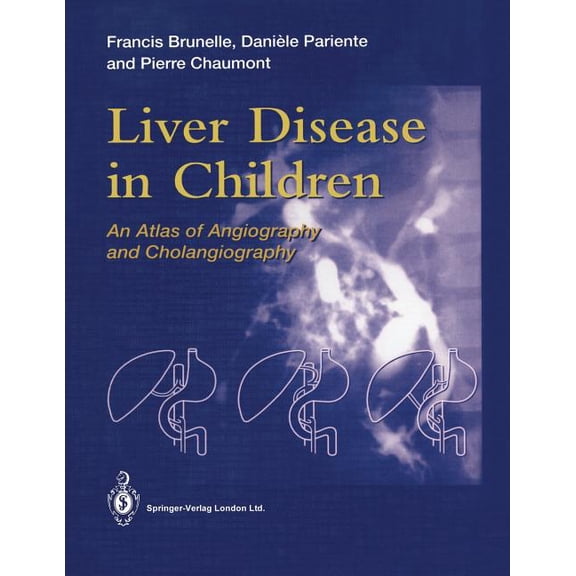 Liver Disease in Children: An Atlas of Angiography and Cholangiography, (Paperback)
