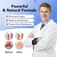 thumbnail image 3 of Toenail Fungus Treatment Extra Strength, 30ML Fungal Nail Treatment for Thick, Yellow, Discolored Nails, 4 Weeks Toe Nail Fungus Treatment, Ingrown Toenail, Athletes Foot, Nail Growth & Strengthener, 3 of 6