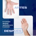 thumbnail image 3 of SKINDRY Sensitive Desodorante Mujer y Hombre para Pieles Sensibles y Sudoración Excesiva | 48 hrs de, 3 of 9