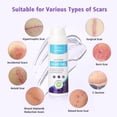 thumbnail image 4 of Crema de silicona para cicatrices Scar Gel Yarster, 50 ml, para cicatrices nuevas y antiguas, 4 of 8