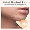 thumbnail image 4 of Pimple Patch RPE Life, hidrocoloide de ácido salicílico, 72 unidades, 4 of 7