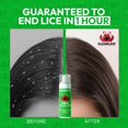 thumbnail image 4 of Kit para el tratamiento de piojos Clearlice Foam 142 g con aroma a menta, 4 of 5