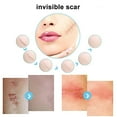 thumbnail image 3 of Bumphree Razor Bump Treatment, 3 of 4