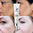 thumbnail image 4 of Effective Whitening Freckles Cream Remove Dark Spots Fade Melanin Anti-Pigmentation Improve Dullness Fast Brighten Skin Care New, 4 of 5