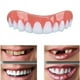 thumbnail image 1 of Dos juegos de dentaduras postizas, prótesis de mandíbula superior e inferior, naturales y cómodas, protegen los dientes y restauran una sonrisa segura., 1 of 5