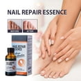 Usc Start Datetoenail Files Thick Toenails