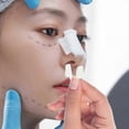 thumbnail image 2 of 2-Pack Nostril Retainers for Rhinoplasty/Septoplasty Support (M/L Sizes), 2 of 4