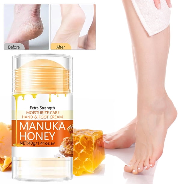 Crema exfoliante para pies con extracto natural para pies secos y agrietados - Hidratante y removedor de callos de larga duración - Fórmula suave y no irritante con antioxidantes para pieles