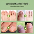 thumbnail image 7 of XIRQI 2026 New 5 Pairs Nail Care Patch Ingrown Toenail Correction Patch Ingrown Toe Nail Treatment Soft Nail Repair Patch Foot Care Tool, 7 of 7