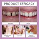 thumbnail image 5 of Denture Adhesive, Thermoplastic Denture Adhesive and Cushion for 7 Days, 5 of 5