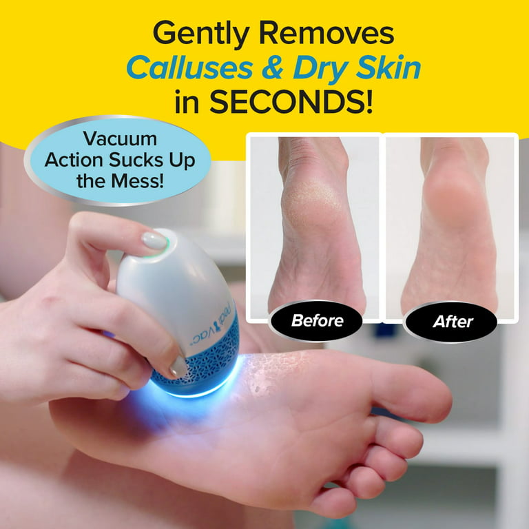 As Seen On TV PediVac Electric Callus Remover with Built-In Vacuum