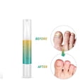 thumbnail image 1 of Fiudx Líquido Reparador de Uñas, Fórmula Hidratante y Fortalecedora, Infusión de Aceite de Aloe Natural, Lápiz de Fácil Aplicación, Cuidado Diario de Uñas, Rutina de Belleza para Adultos, Hecho En Au, 1 of 6