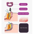 thumbnail image 2 of Kids Sleep Strips, Breathable Self Adhesive Mouth Strips Reducing Mouth Breathing Anti Sonring Soft Mouth Tape For Children, 2 of 5