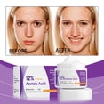 thumbnail image 4 of Pisexur Belleza Maquillaje Crema facial con suero azelaico Crema facial con suero azelaico Crema facial con suero facial Crema facial con ácido hialurónico para aliviar el para mujeres y hombres, 4 of 9