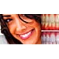 thumbnail image 5 of Expertwhite Extreme 44% Teeth Whitening Gel (6-gels) Free Shipping, 5 of 5