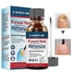 thumbnail image 1 of 1-3x Nail Fungus Solution Bacteriostat Nail Fungus Toenail Removes Callus Dead Skin Pedicure Foot Care Tools 1pcs, 1 of 2