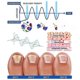 thumbnail image 3 of 2025 2024 New Nail Fungus Laser Device Light Therapy Osis Toes Treatment, 3 of 5