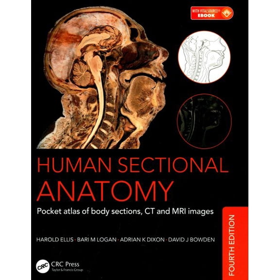 Pre-Owned Human Sectional Anatomy: Pocket Atlas of Body Sections, CT and MRI Images, Fourth Edition (Paperback)